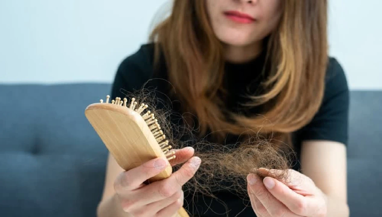 Struggling With Severe Hair Loss? These Vitamin Deficiencies Could Be The Hidden Cause!