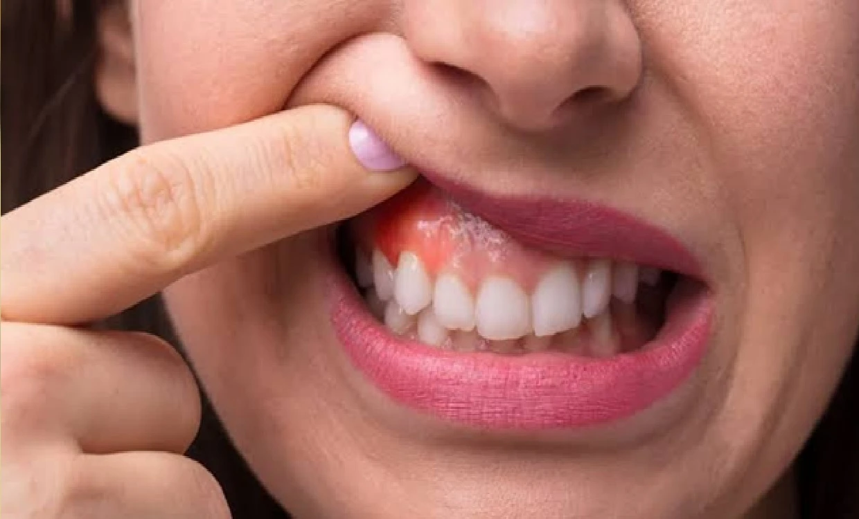 Diabetes and Bleeding Gums: Causes, Symptoms, and Expert Dental Care Tips
